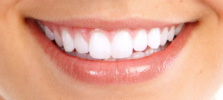 Teeth Whitening London