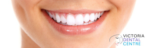 Teeth whitening London Victoria Dental Centre